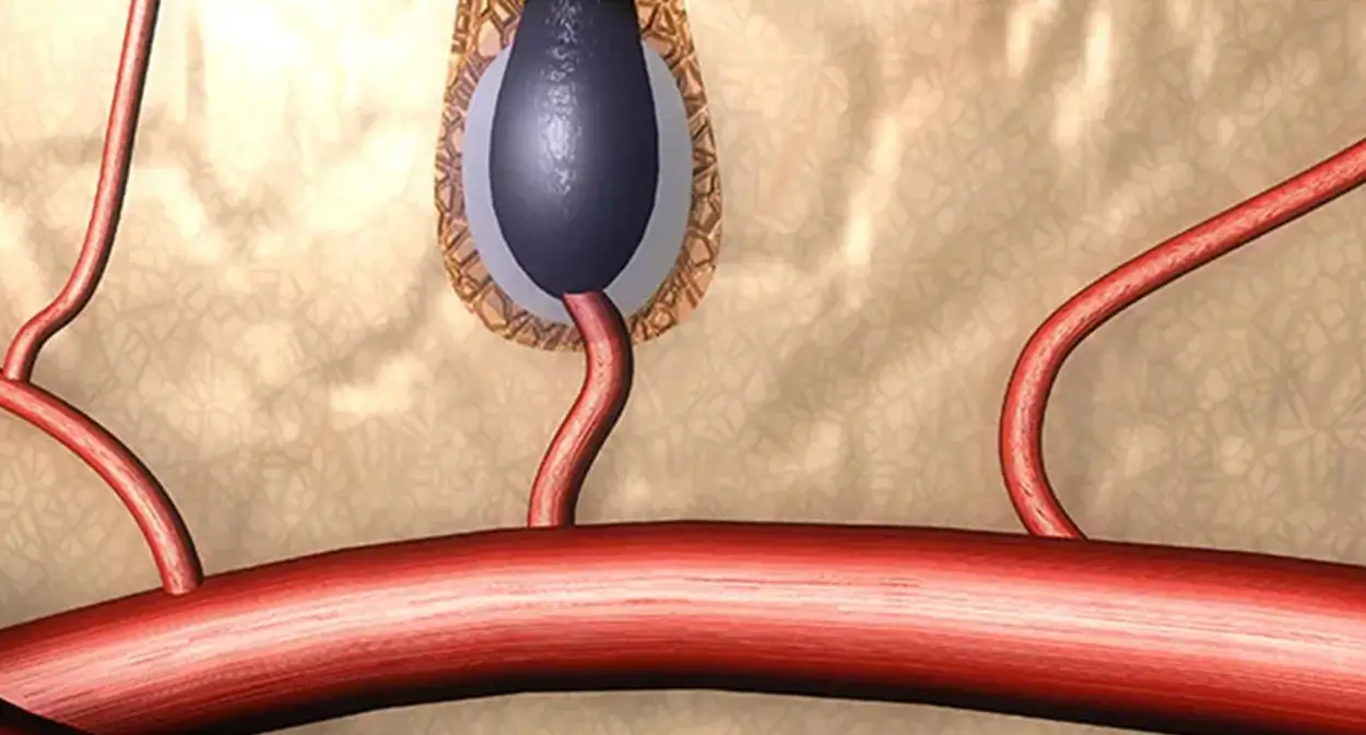 هیرآکسیل رشد مجدد موها را تحریک می‌کنند